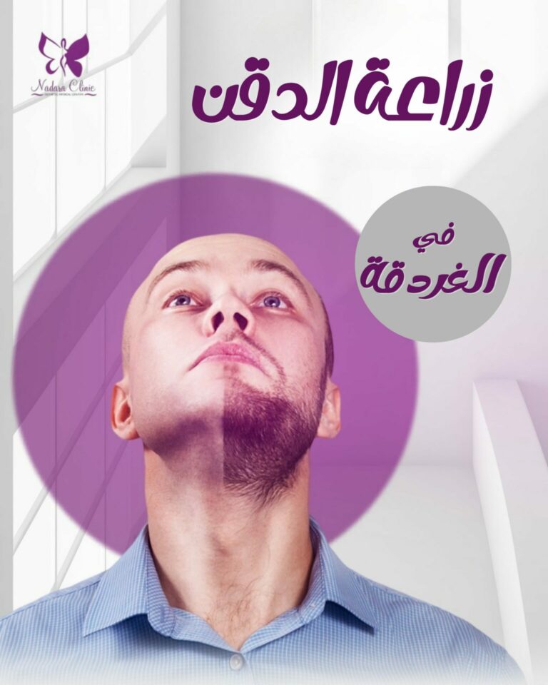 إنبات الذقن في الغردقة